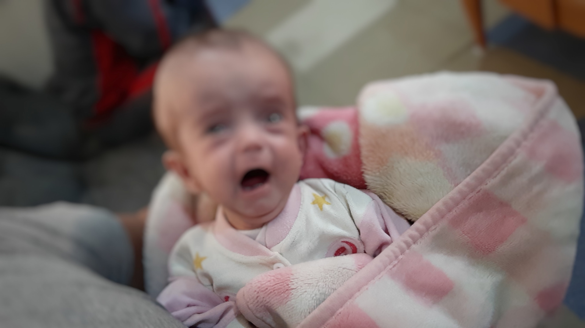 طغلة تعاني من استسقاء دماغي!