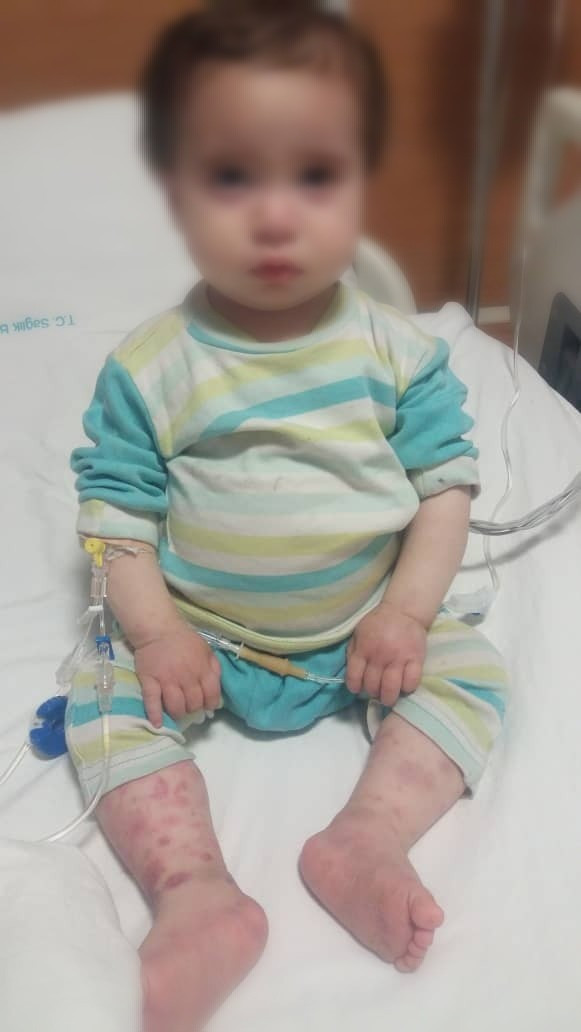 a child needs a bone marrow transplant