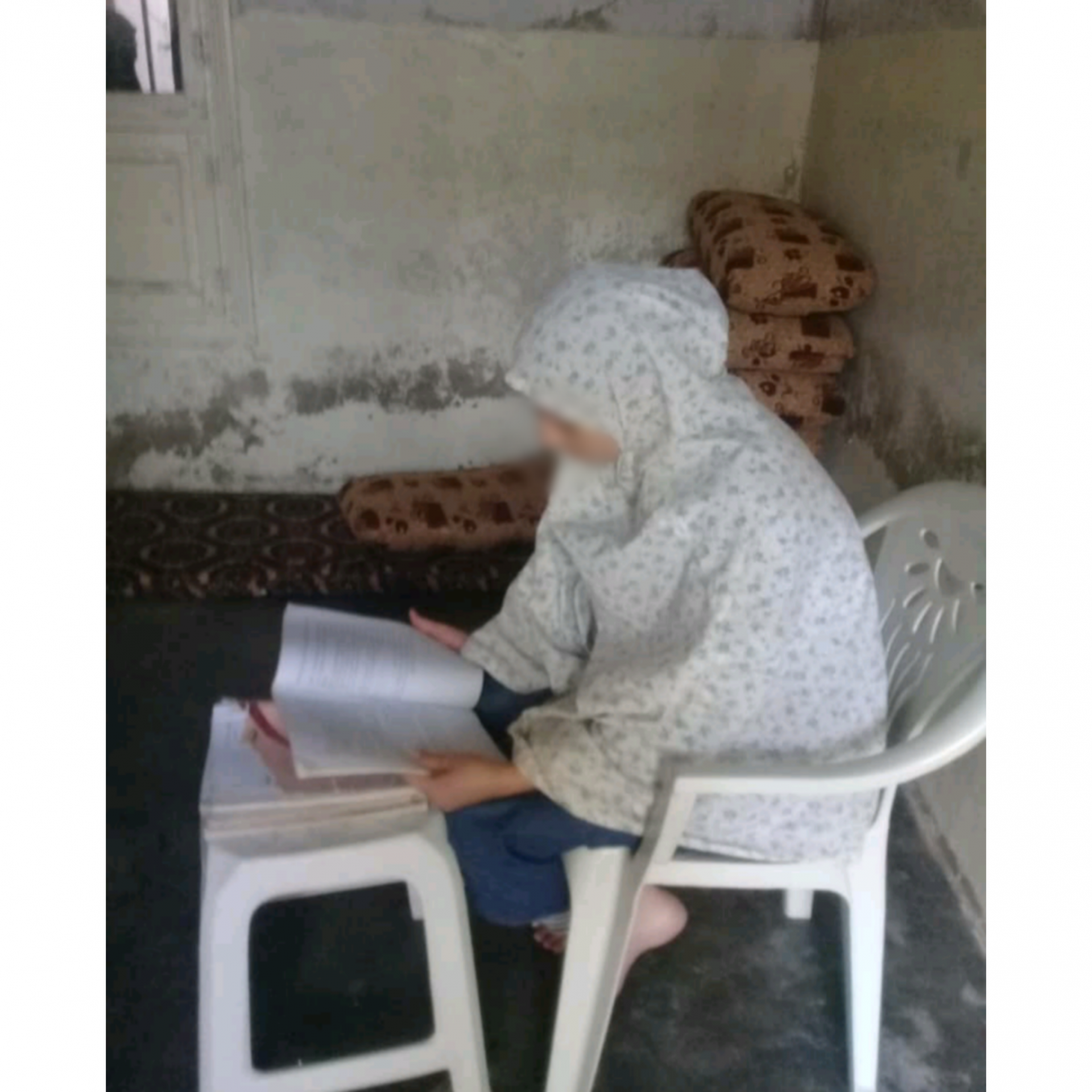 فتاة تعاني من ماء بيضاء في عينها