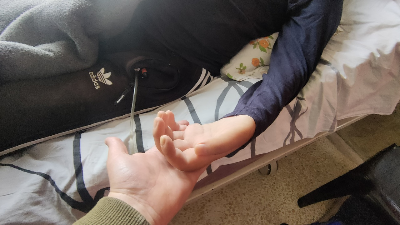 شلل كامل يعاني منه أنس، وسوء الأوضاع المعيشية تعاني منه عائلته
