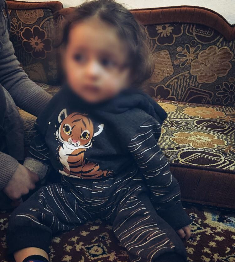 A child with cerebral atrophy