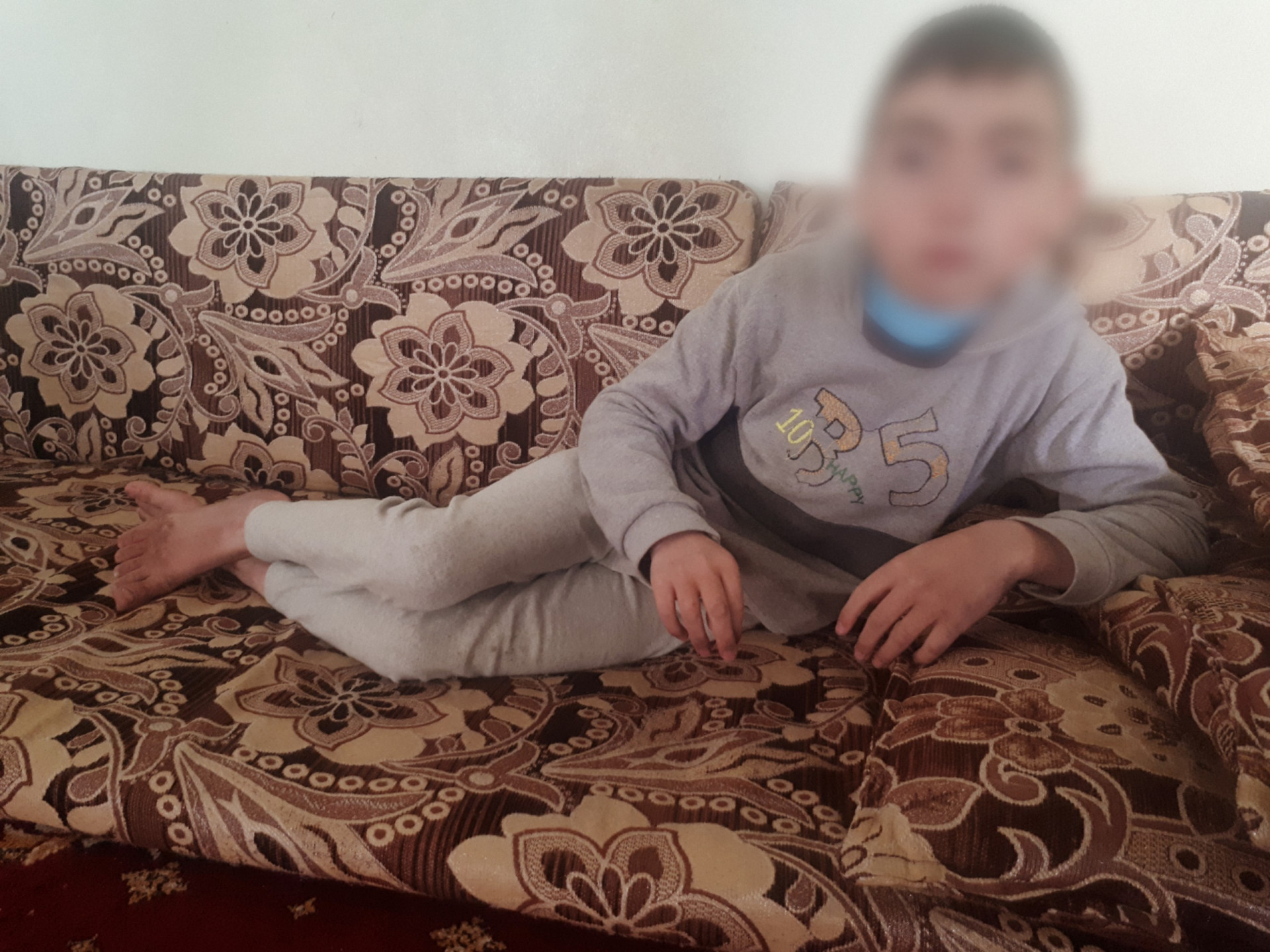 A child with cerebral atrophy
