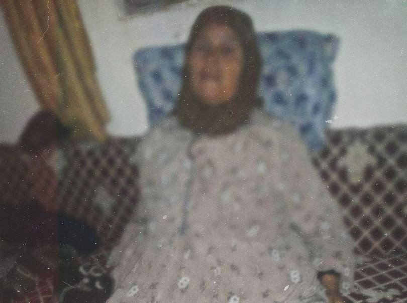 An elderly woman with arthritis