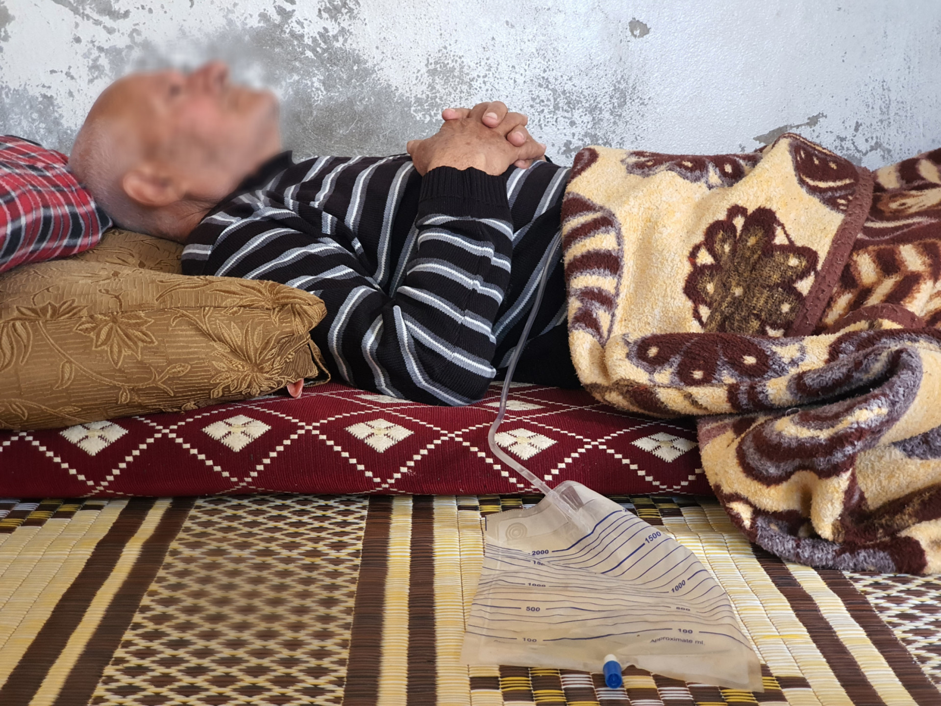 For about a year, Mohammad suffers from kidney stones pain that needs lithotripsy