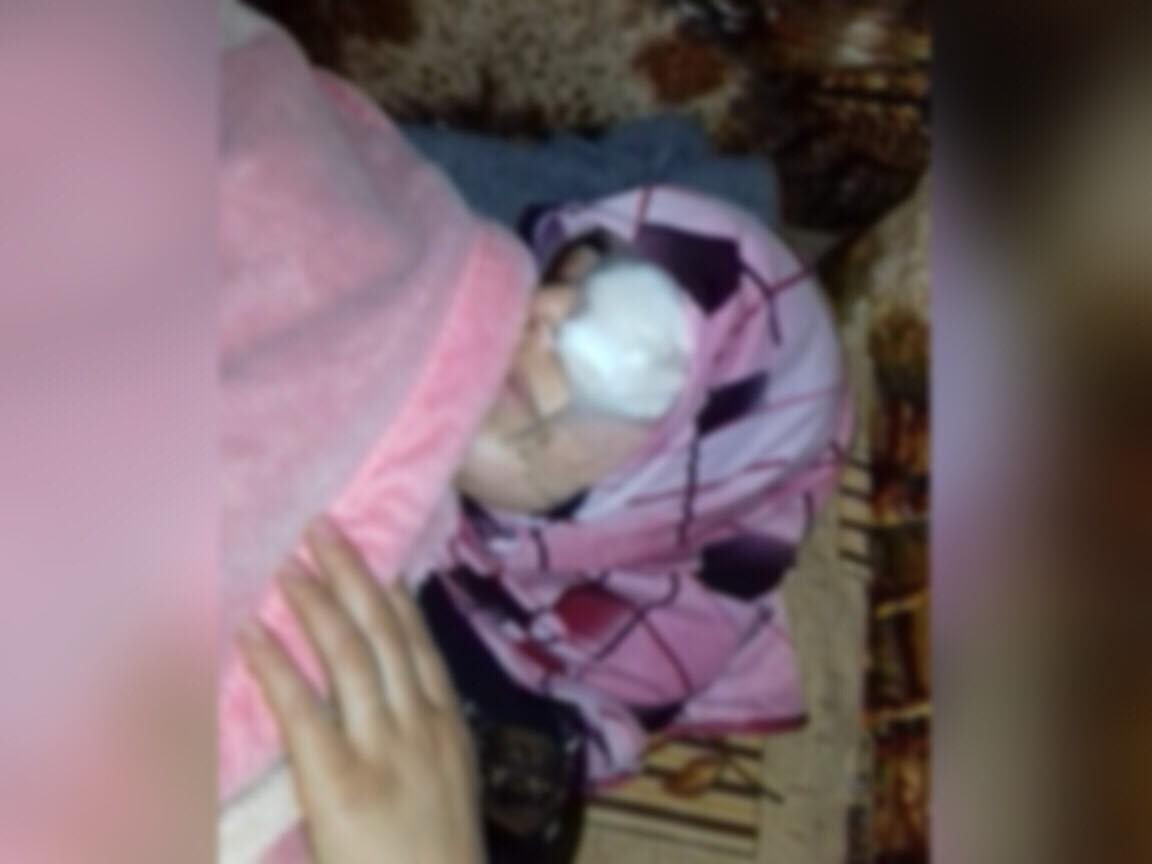 A women in need for urgent surgery