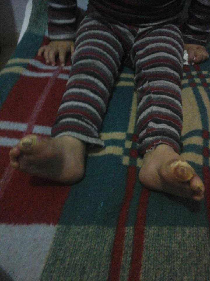 Child needing treatment expenses