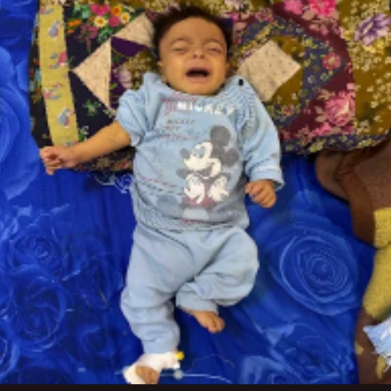 طفولة تُصارع من أول نفس