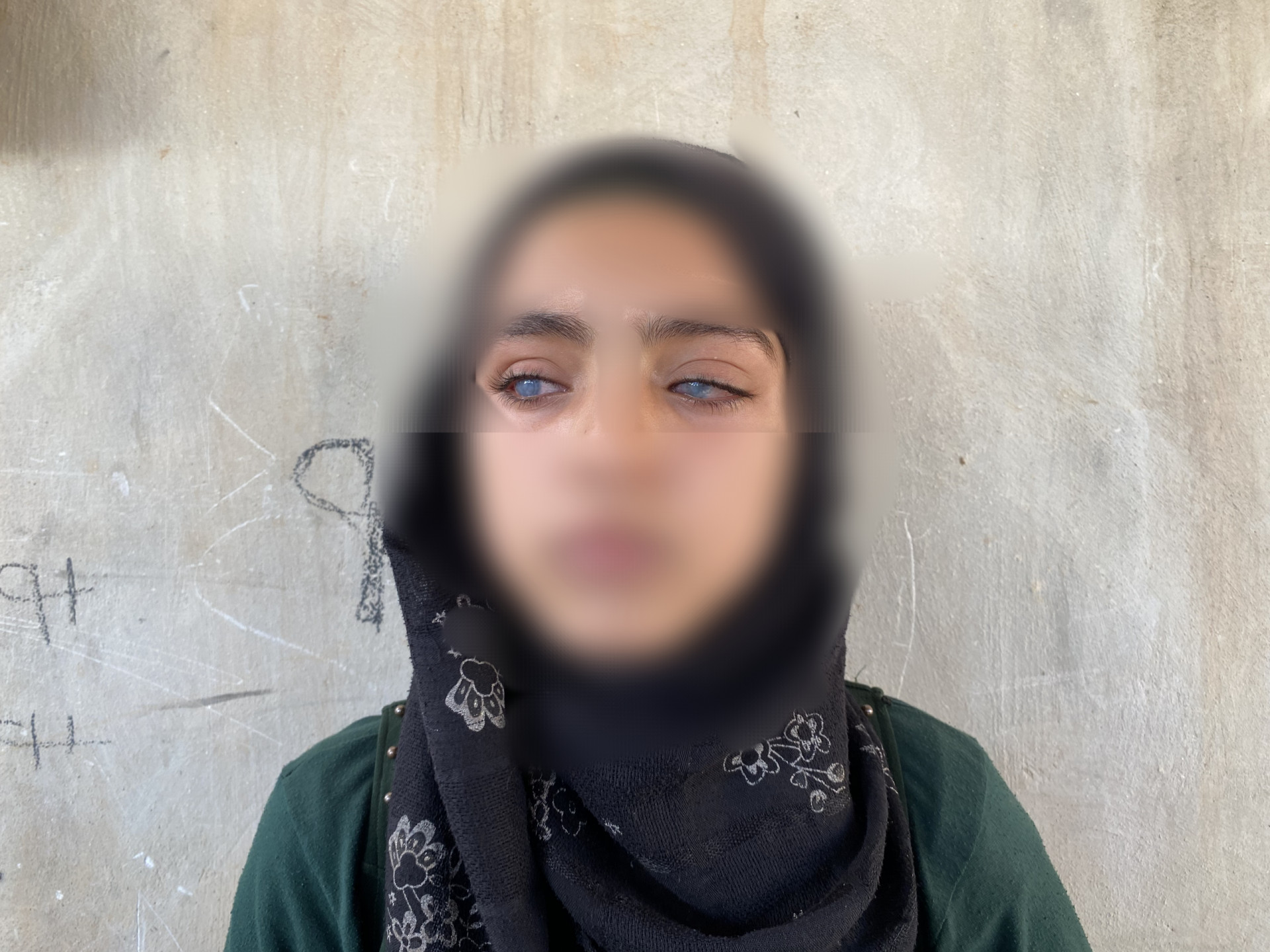 Urgent Help Needed to Save Shahad’s Eyesight