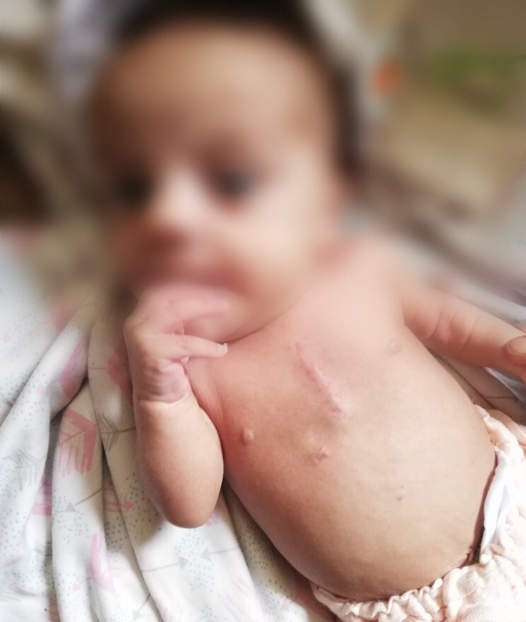 A father suffering from kidney pain and a baby with atrial defect
