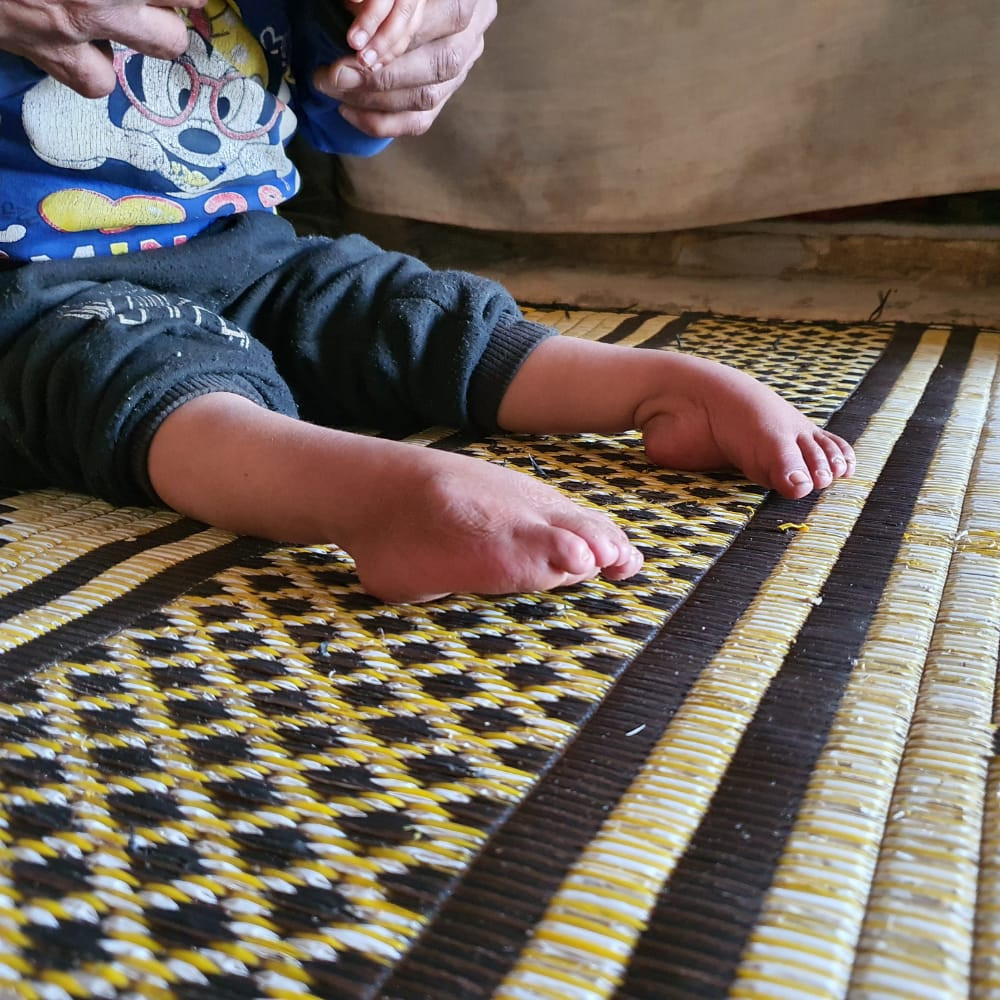 الطفلة دلال من ذوي الاحتياجات الخاصة وبحاجة الى أدوية ومستلزمات خاصة