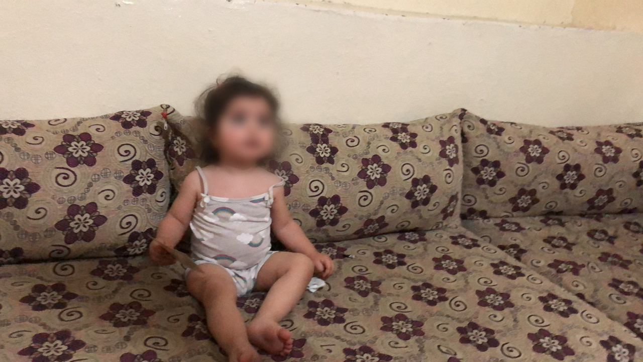 Baby Born with Hip Dislocation Needs Urgent Surgery