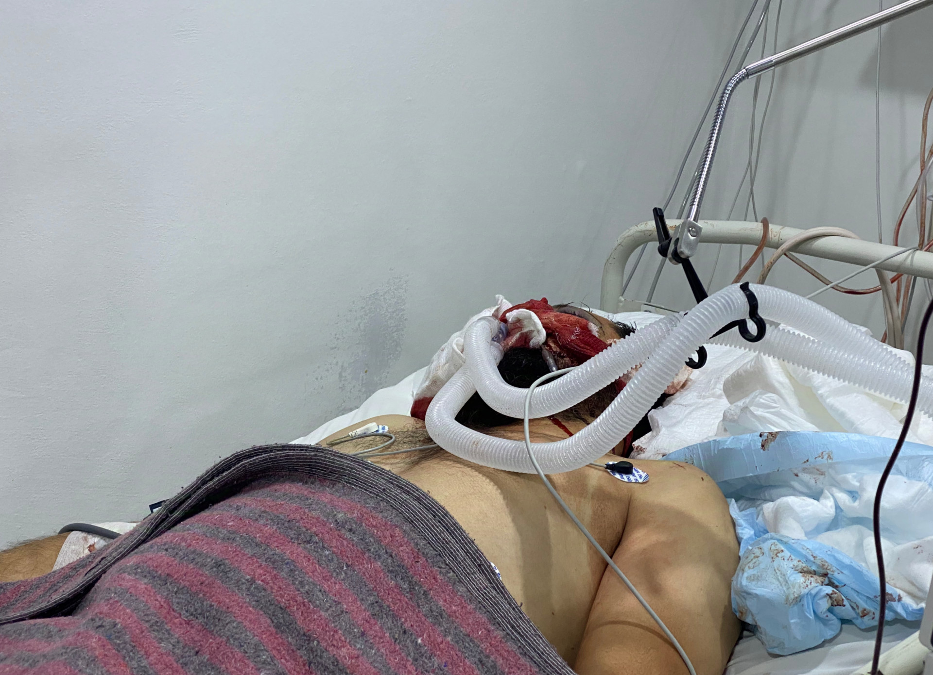 Support Mohammed in His Battle for Survival