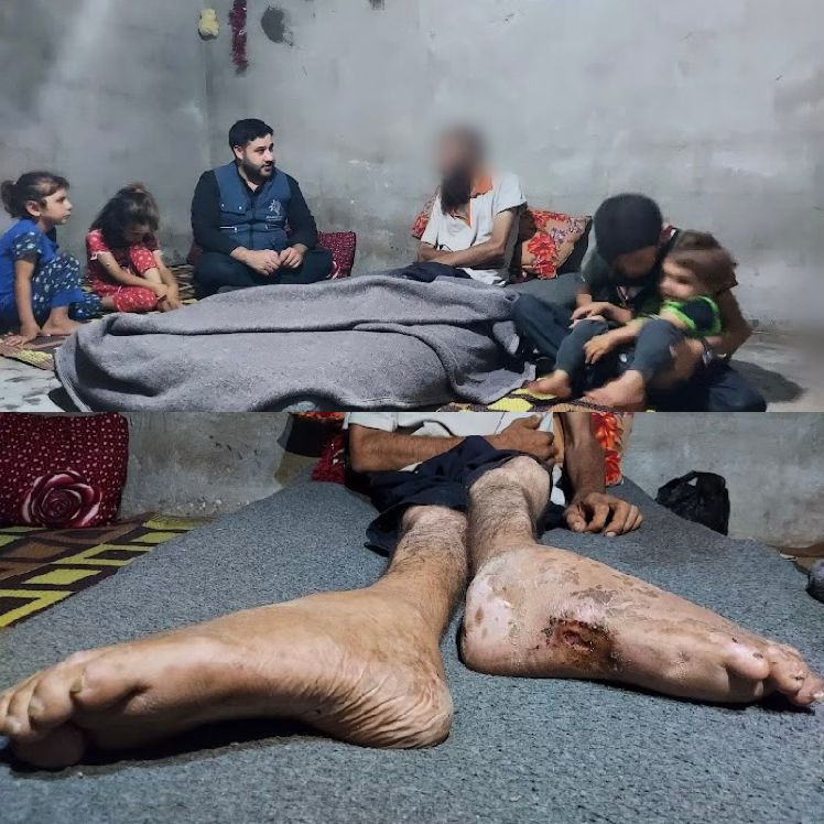 He lost his ability to walk due to a sniper's bullet