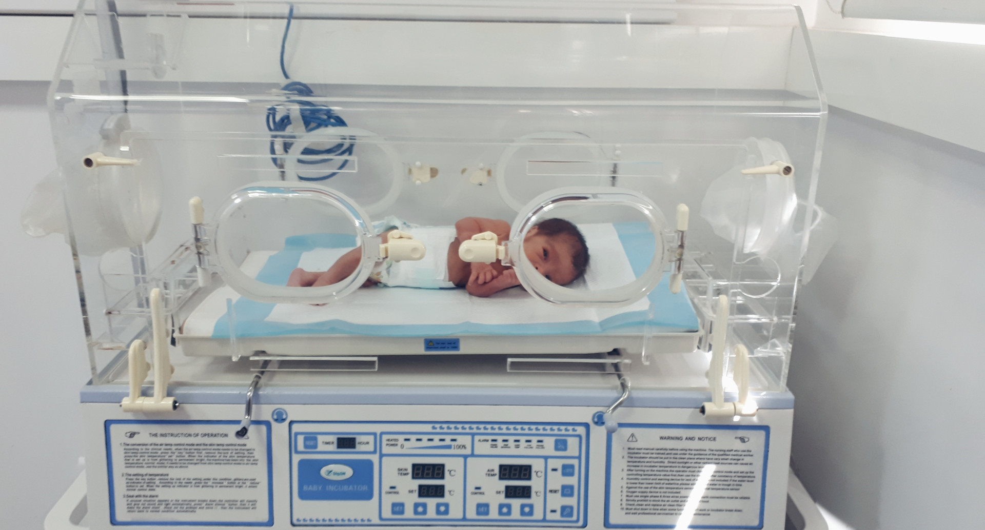 A child was born after 31 weeks of pregnancy