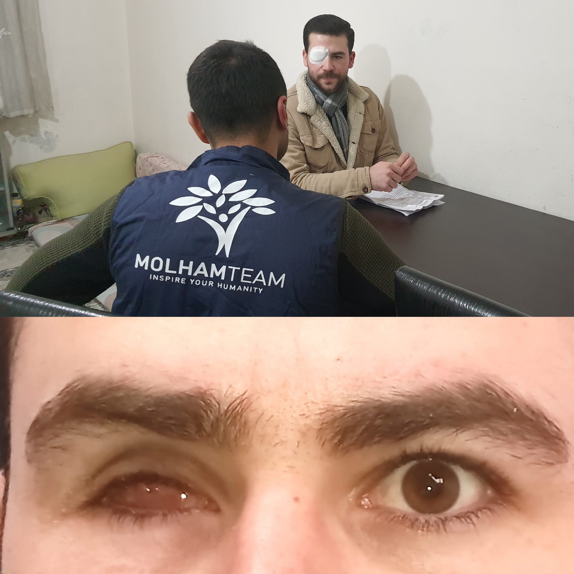 He lost one eye, and got injured in the other one. Osama needs your help to treat his eyes!