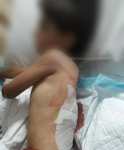 A child needs treatment expenses to be covered
