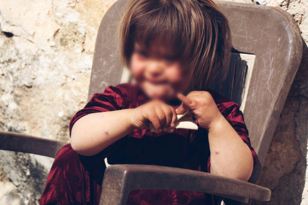 A child with Down syndrome, lives in a hen house