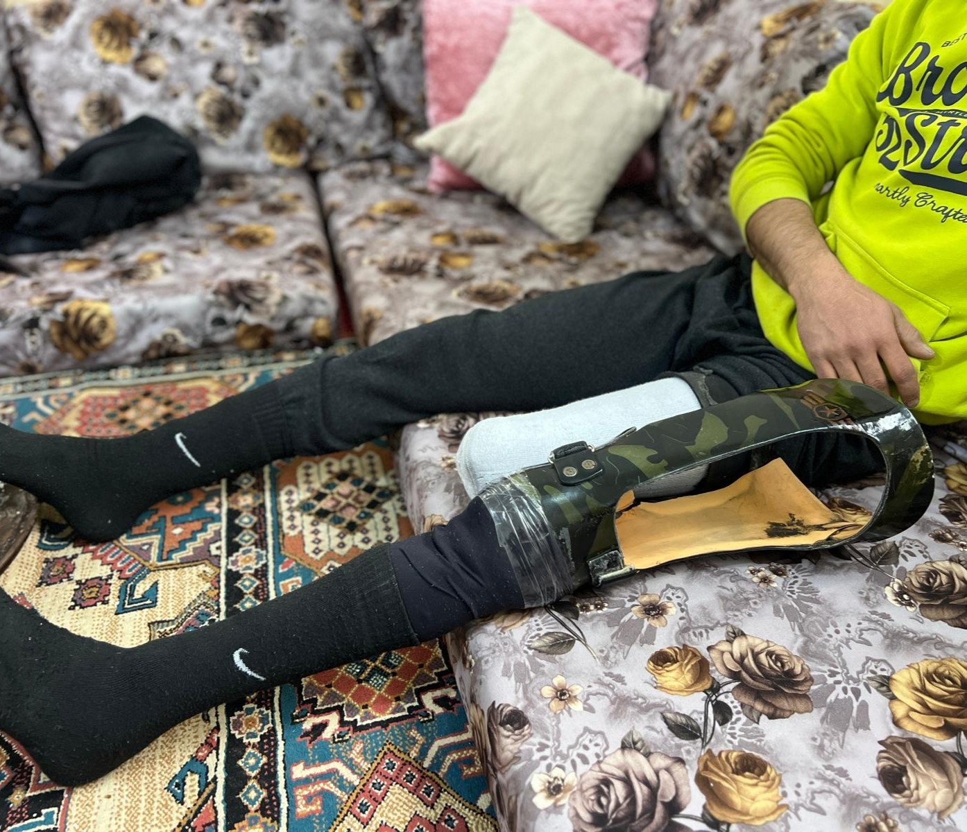 ساقٌ مفقودة