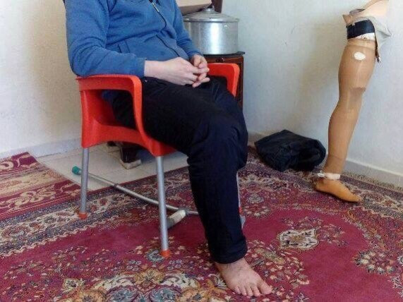 شاب بحاجة طرف صناعي