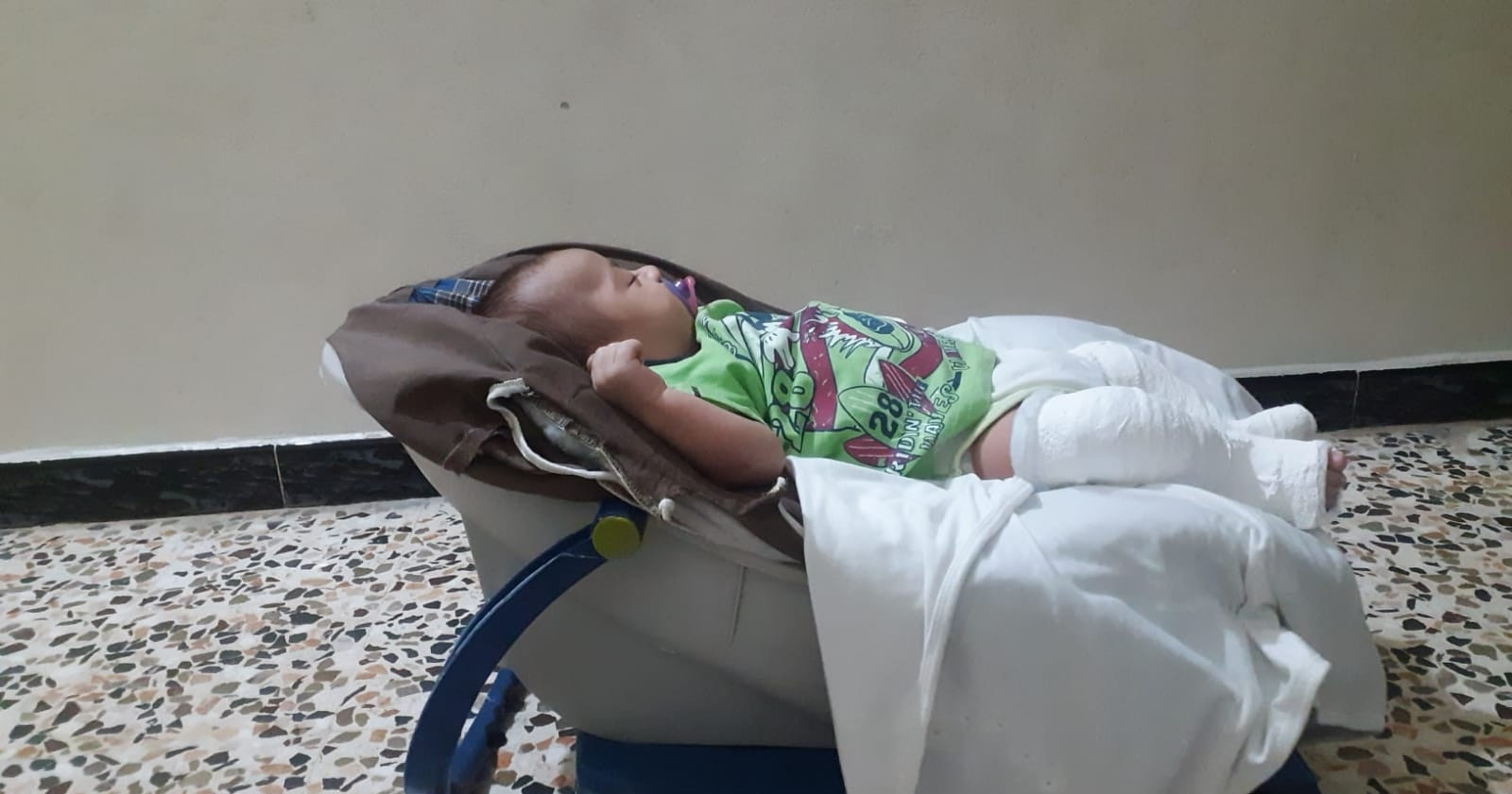 Yamen was born with clubfoot & needs treatment expenses.