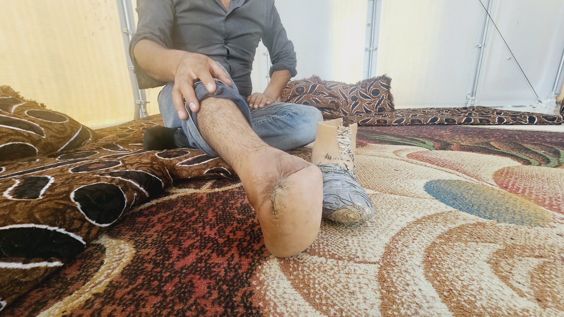 A Harsh Attack Changed Uncle Ahmad’s Life to Days of Hardship