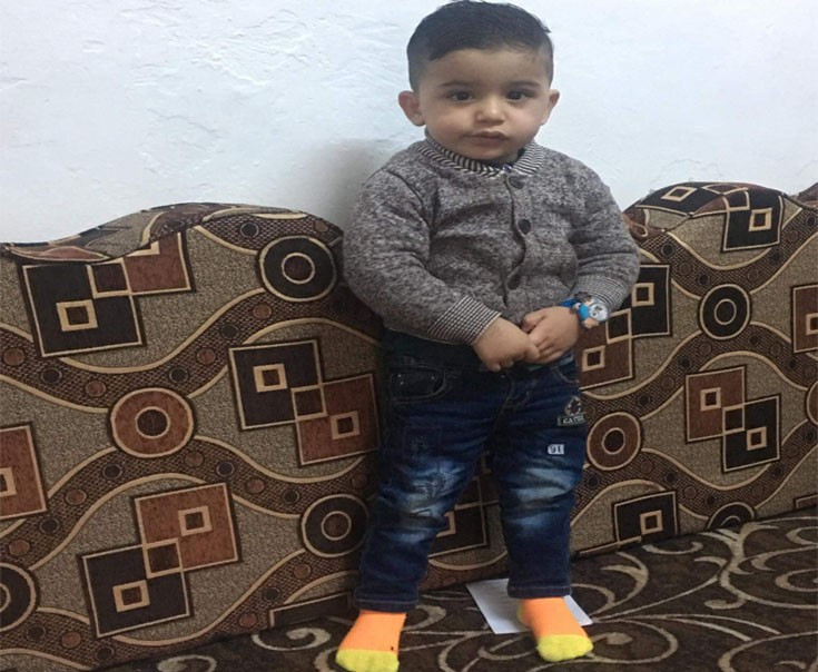 An infant in need for milk special formula and food supplements