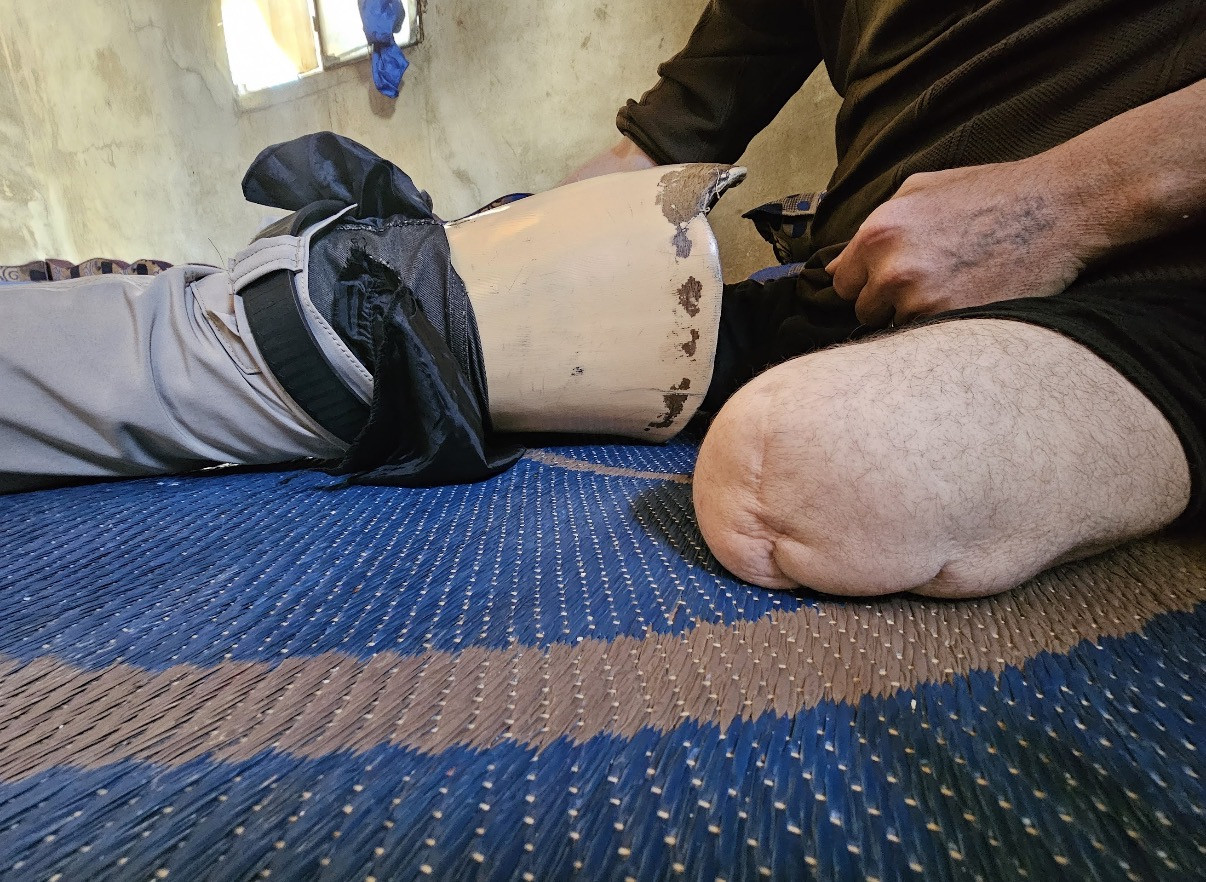Raed… Between Injury and Mounting Debt
