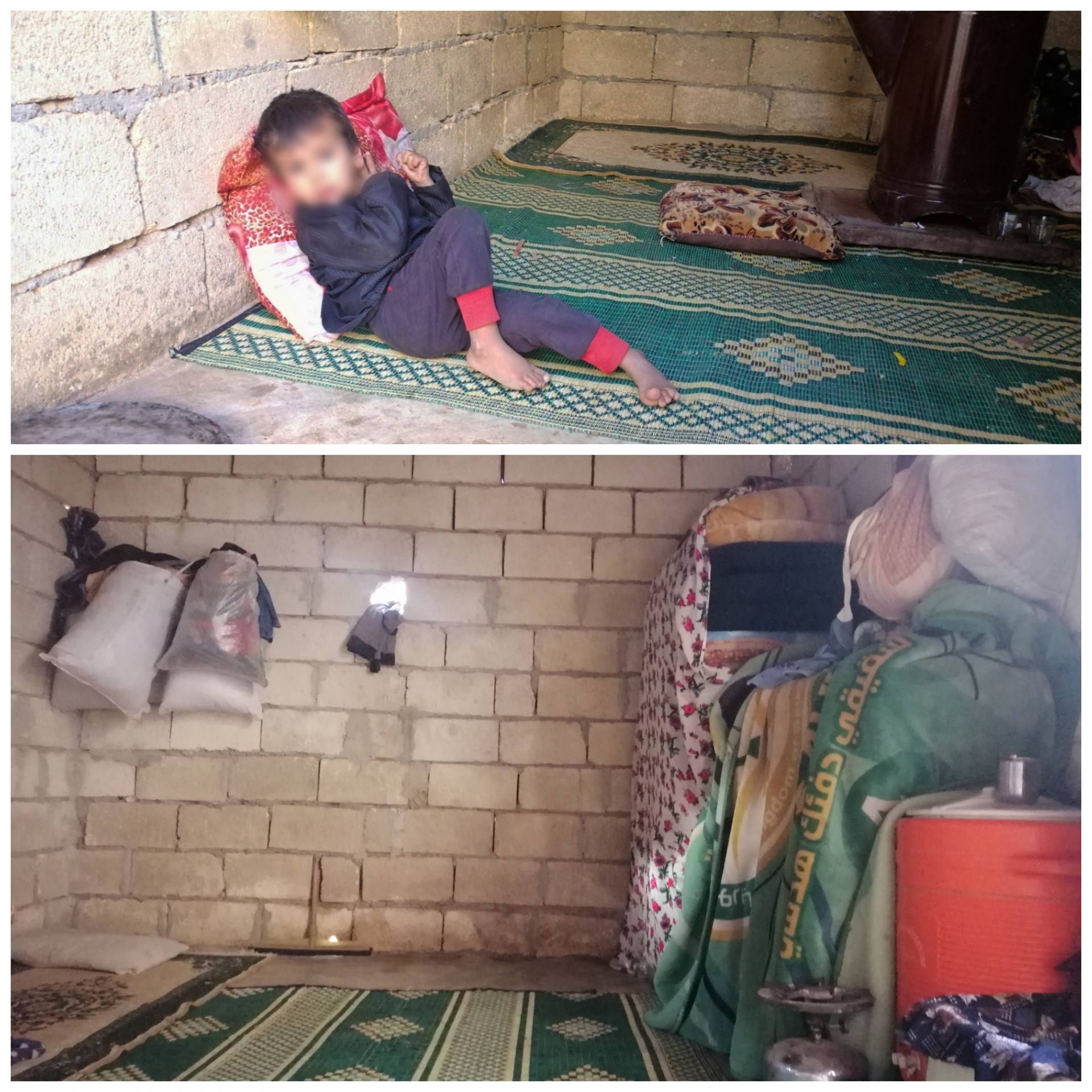 Abdul Qadir suffers from cerebral atrophy since birth