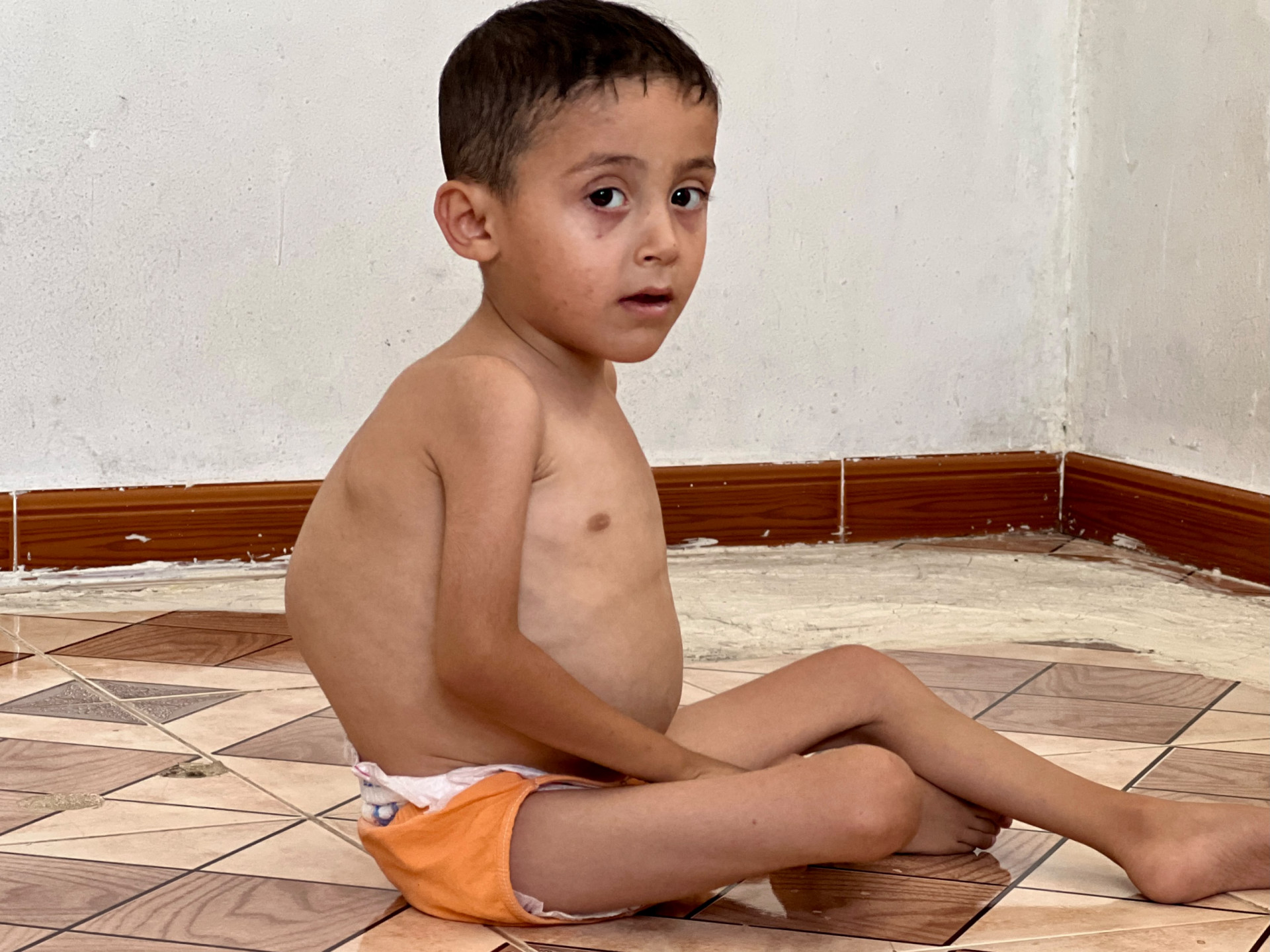 طفولةٌ ينغّص بهجتها المرض!