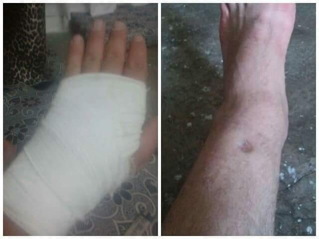 family needs support after the injury of the breadwinner