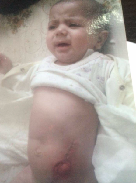 A Child in Need to Undergo a Surgery