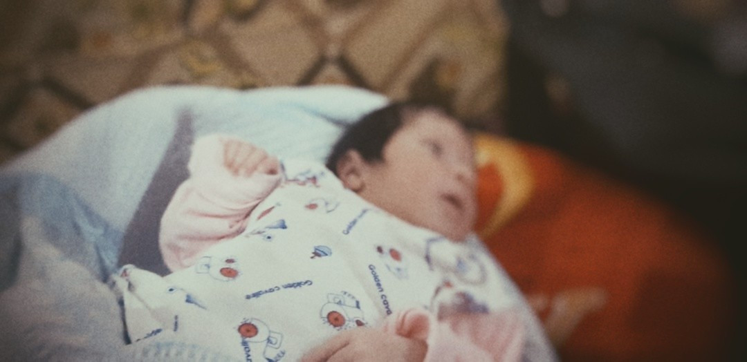 A newborn girl with a spina bifida