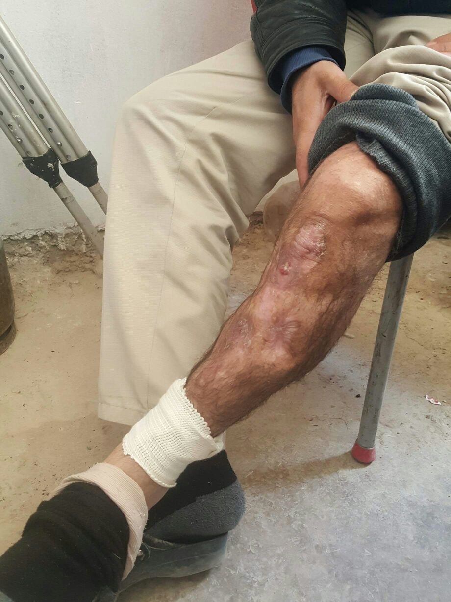 A Young Man in Need of a Surgical Intervention
