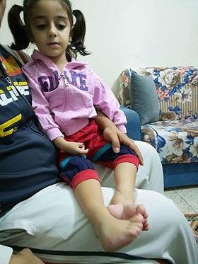 Surgery and medical shoes needed for a kid
