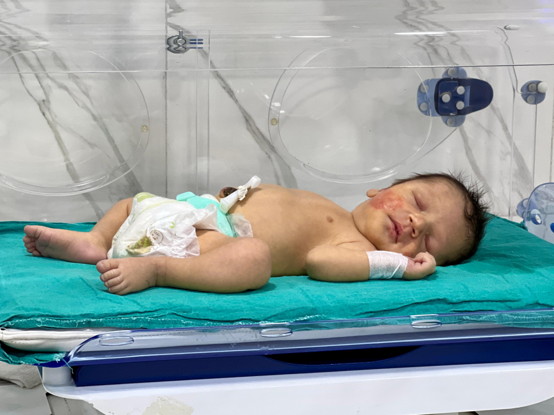 معاناة منذ الولادة