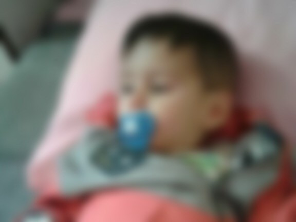 A child suffering from hernia