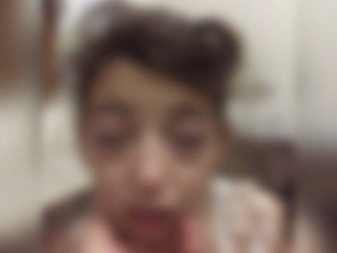 A child needs to pay for her treatment