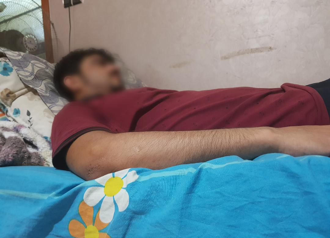 شاب فقد بصره!
