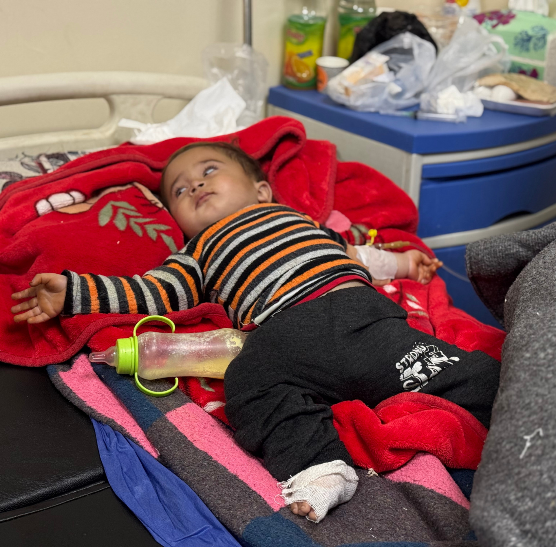 A Burned Foot, a Childhood on Hold