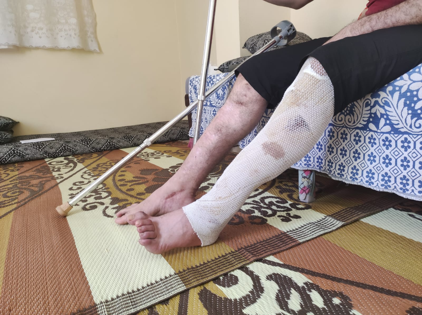 Ahmad cannot work and support his family due to injury