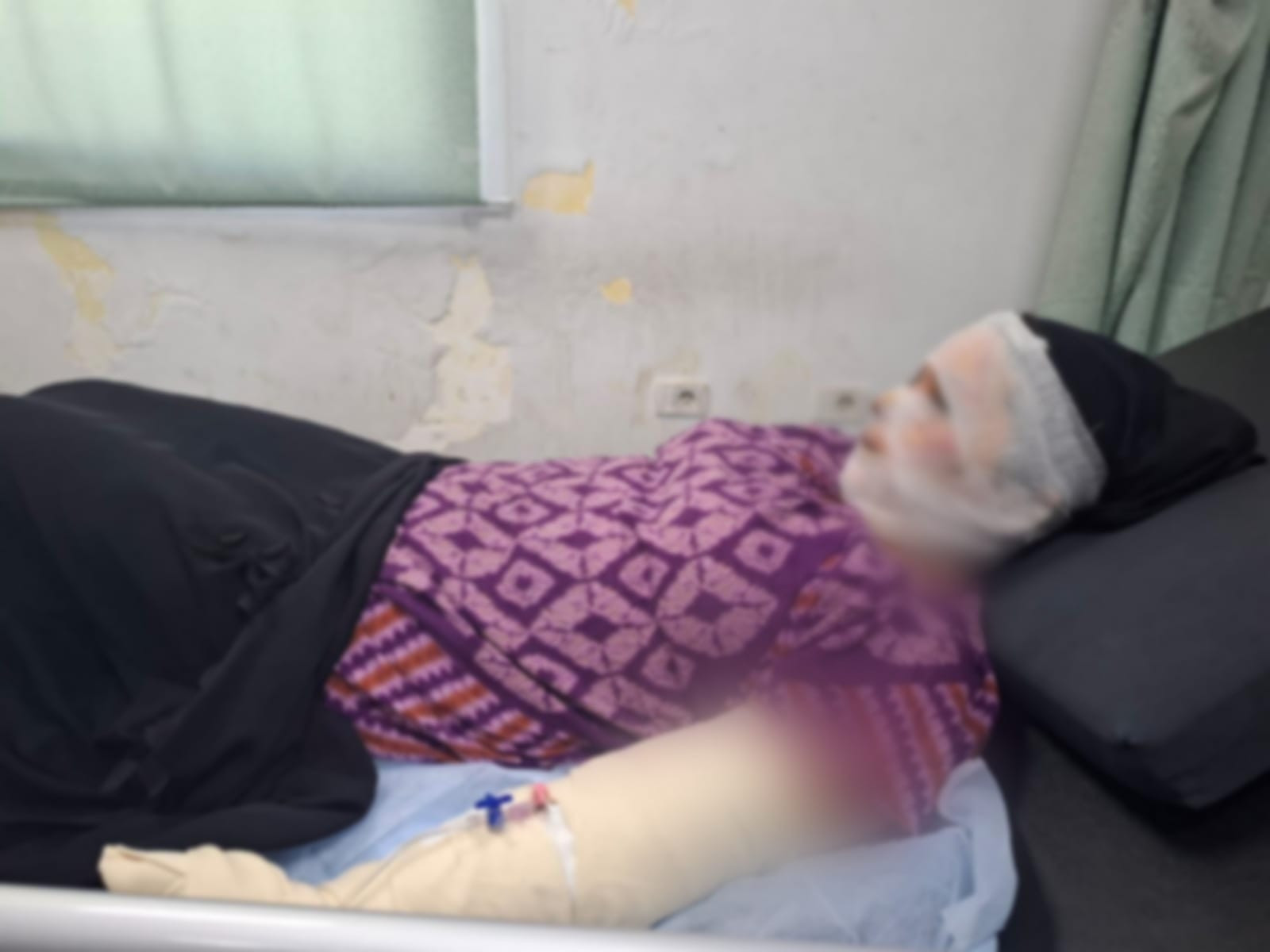 A gas stove exploded and caused her severe burns!