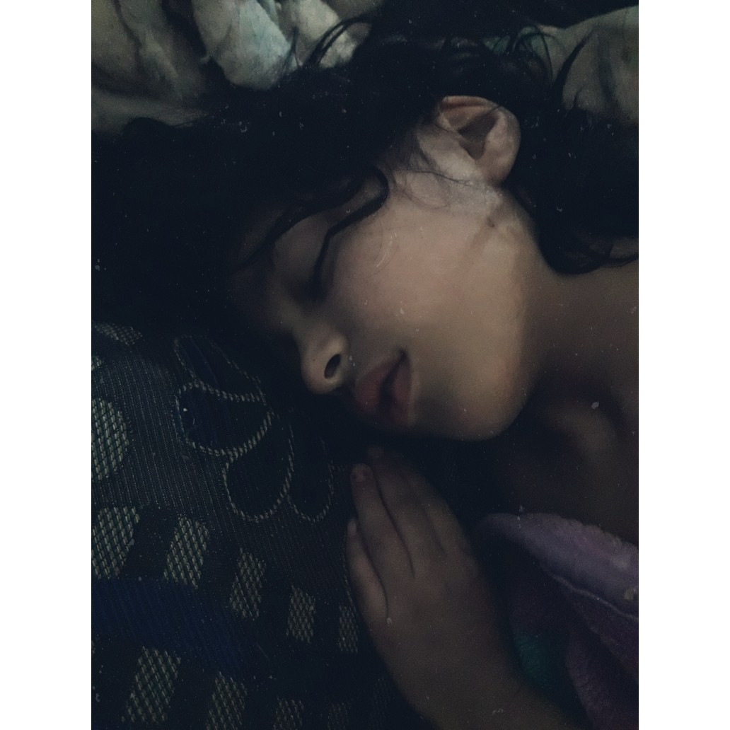 a child with head injury