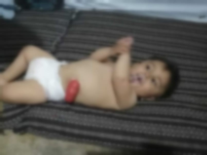 A little child needs urgent surgery