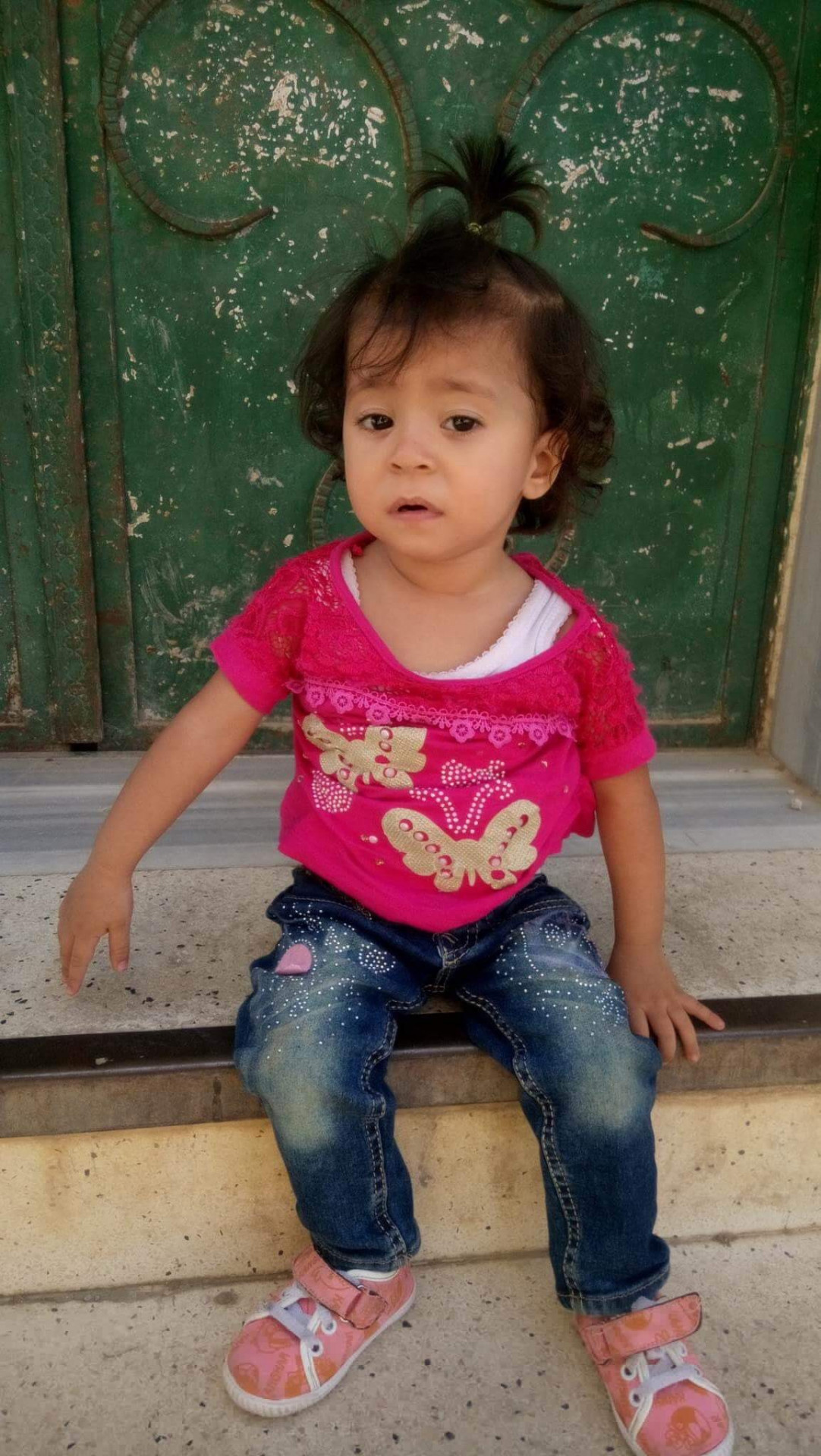 A child in need for hearing aid