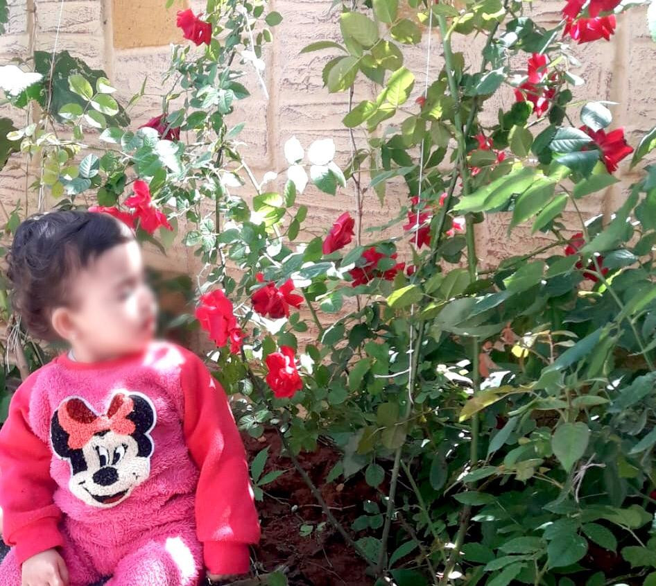 طفلة بحاجة عملية تنظير للرئتين.