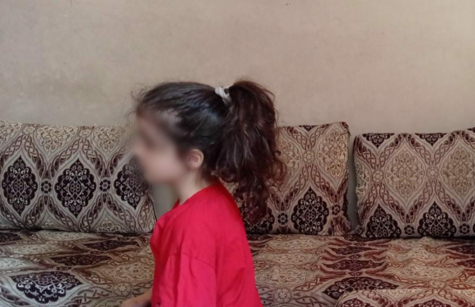 Suffering from brain atrophy and needs treatment