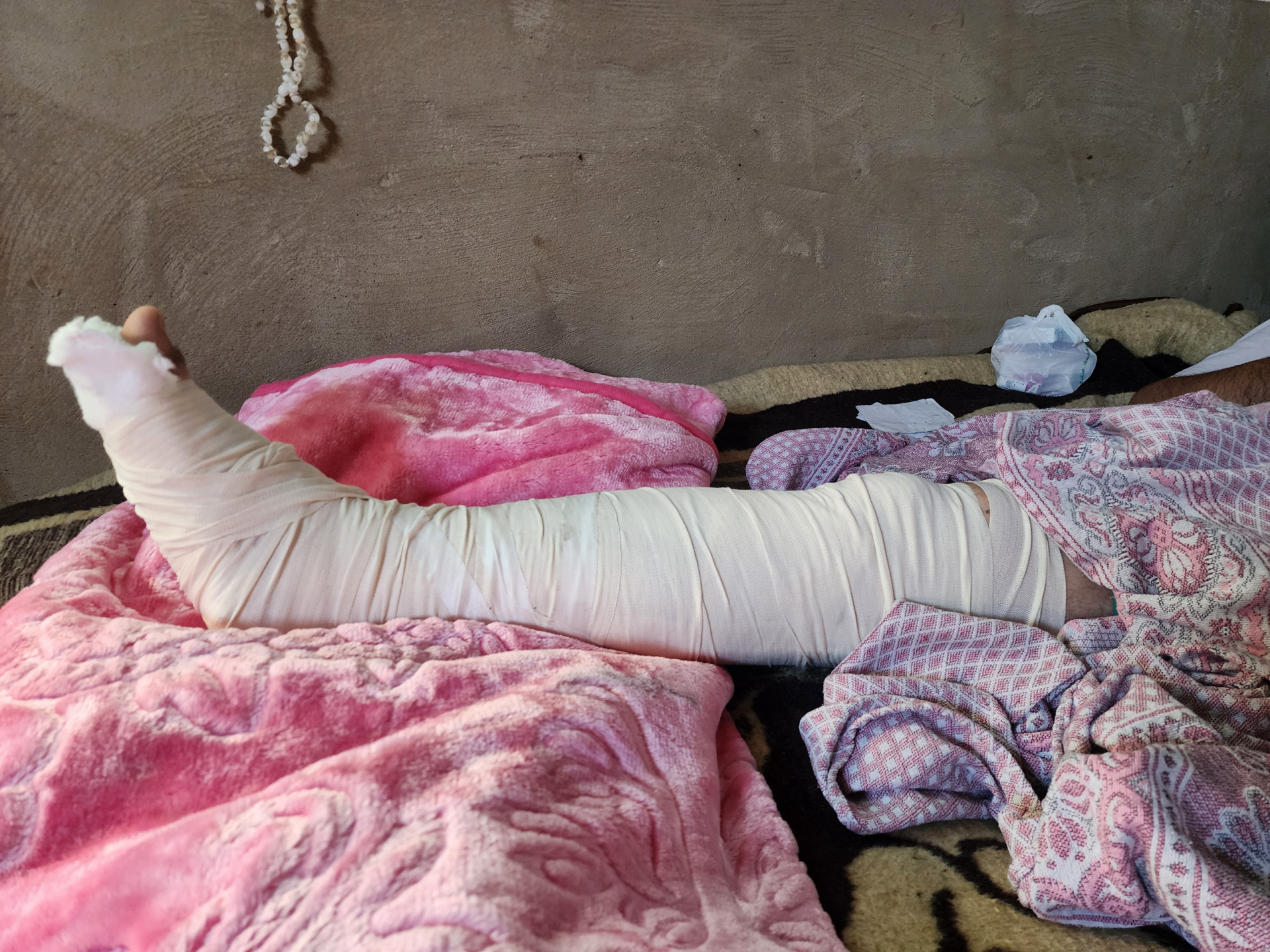 *لؤي طريح الفراش بعد حادث مروع وسط ظروف معيشية قاسية*