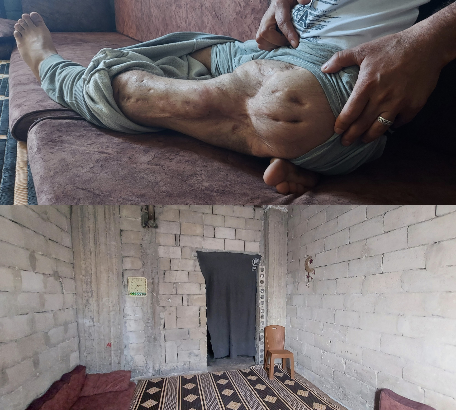 Mahmoud is injured and urgently needs your support to provide for his family.