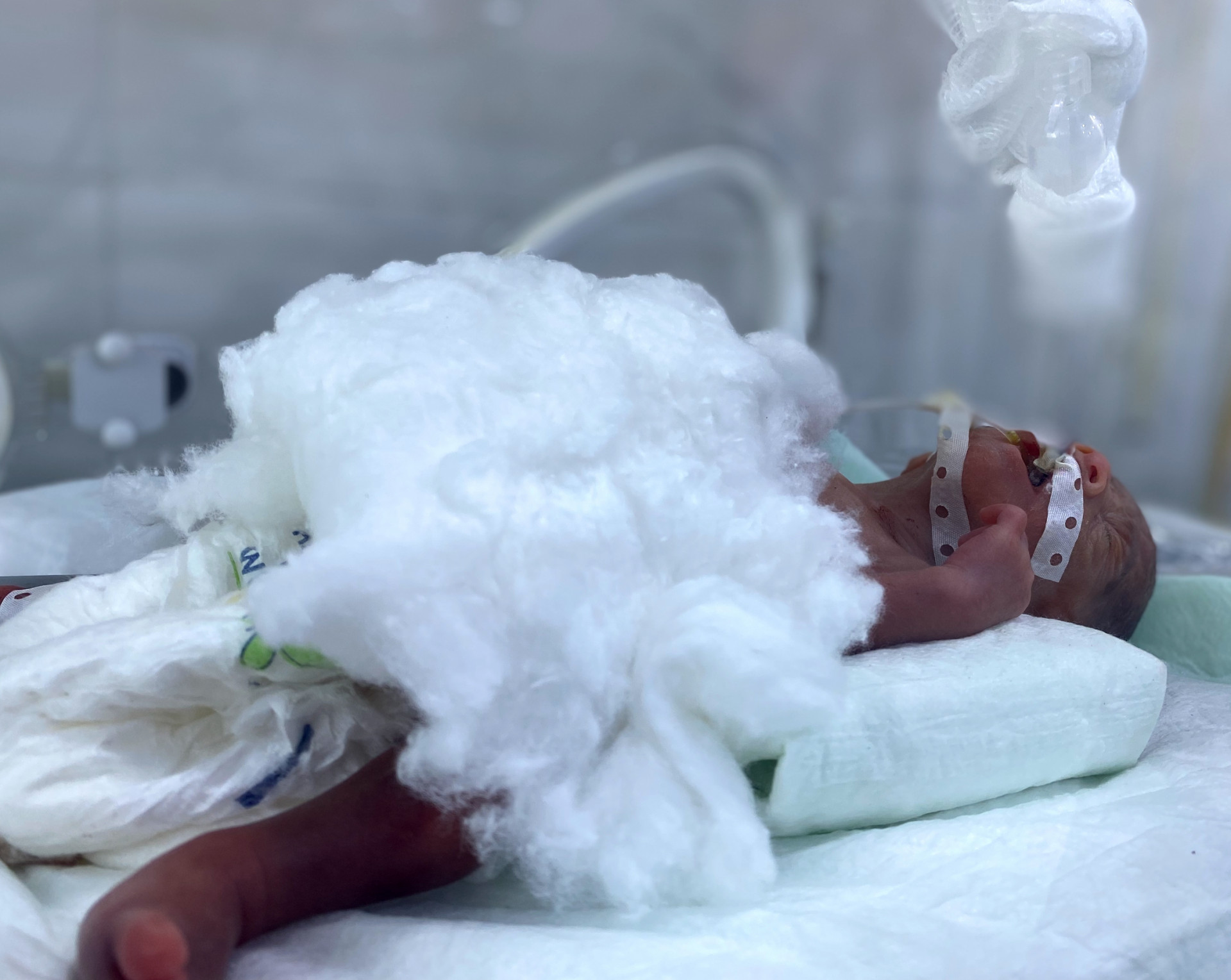 A premature baby needs injections treatment to survive!