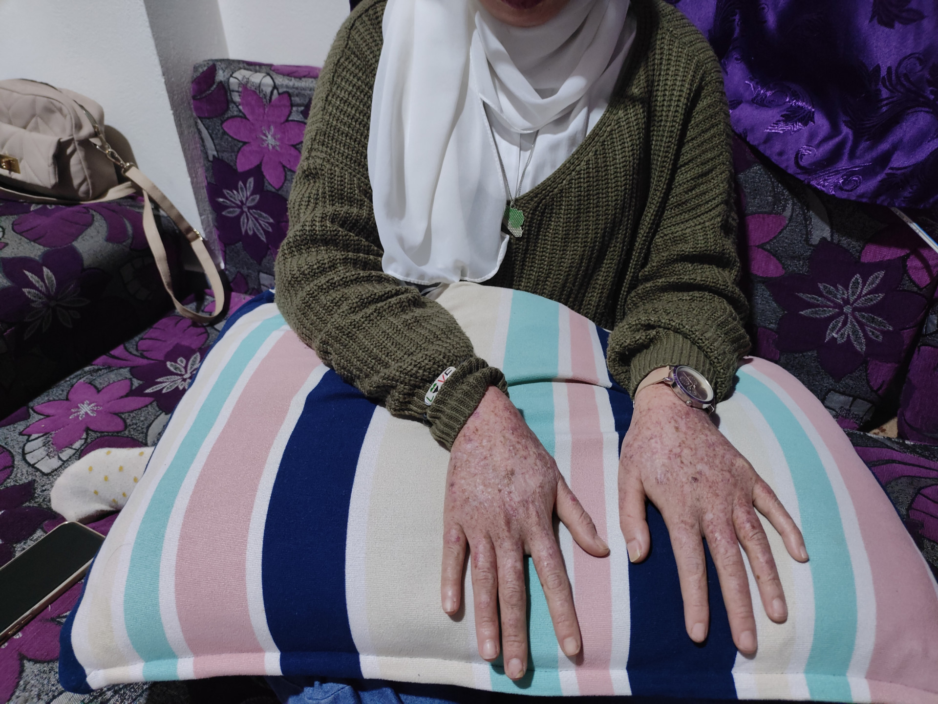 فقر ومرض وآلام